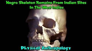 Pre-Colombian Negro Skeleton Remains From American Indigenous Sites In The Caribbean West Indies !!!